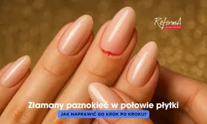 Złamany paznokieć w połowie płytki, który wymaga natychmiastowej naprawy.