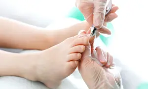 Pedicure: usuwanie skórek wokół paznokci u stóp, które mogą przypominać paznokcie rurkowate.